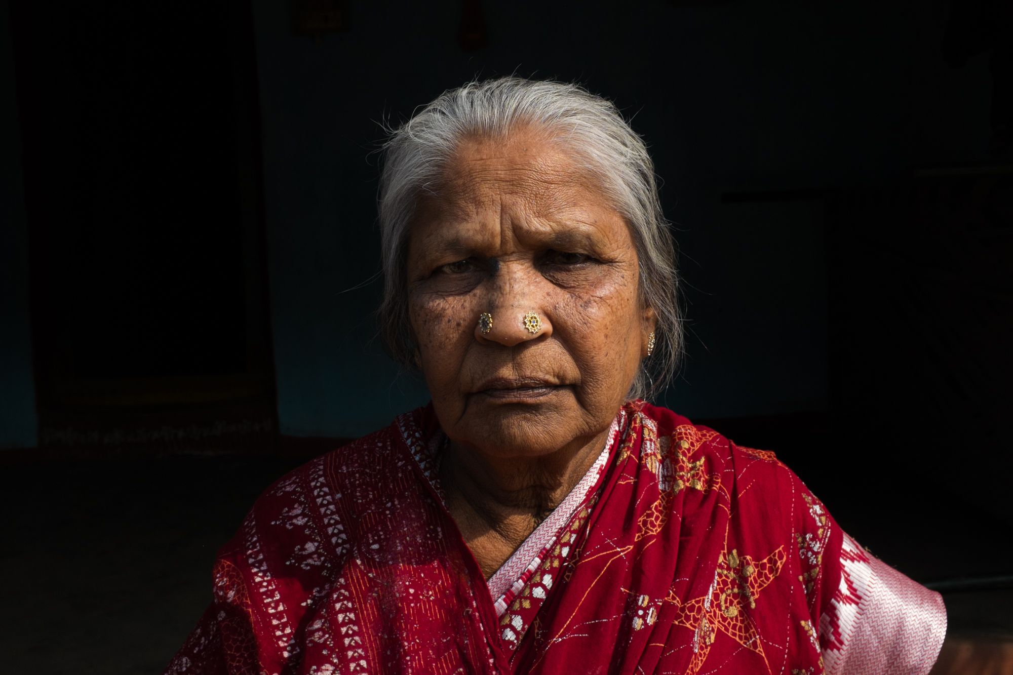 Pandava Suryakantam, 70 of Balliptugga, AP, India is a CKDnT patient and widow of the same disease. Taken on production for documentary film on the Chronic Kidney Disease of non Tradtional cause (CKDnT) epidemic affecting largely rural, poor agriculatura and minng communtiies in Andrah Pradesh and Tamil Nadu States, India.